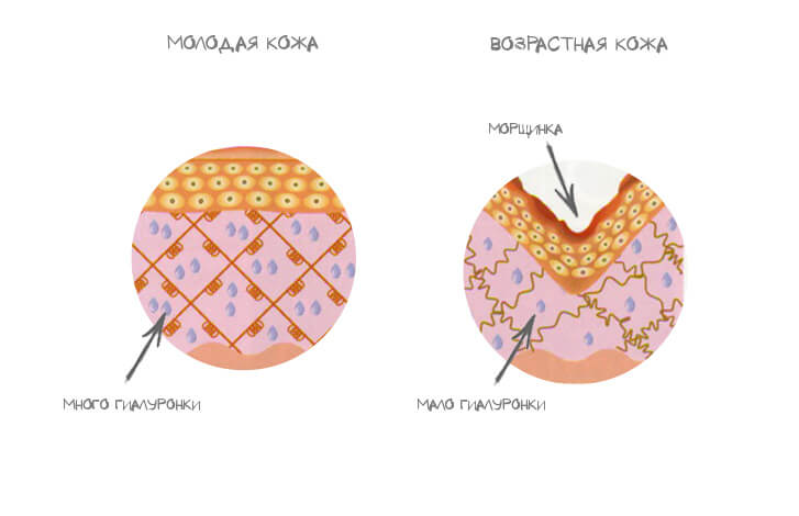 vozrast.jpg